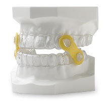 EMA Dental Appliance